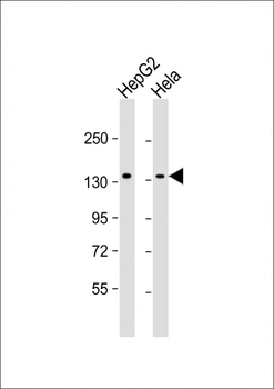 RBM6 Antibody
