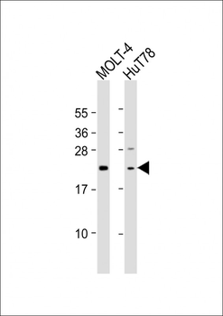 DLEU7 Antibody (N-Term)
