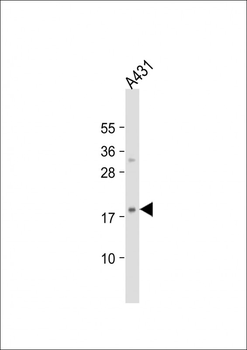 H3f3b Antibody (Center)