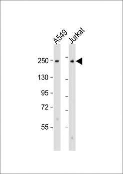 COL11A1 Antibody (N-Term)