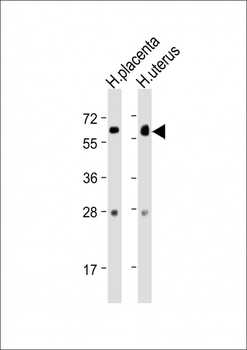 ZBTB7C Antibody (N-Term)
