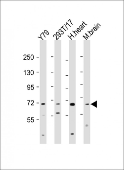 ANO10 Antibody (C-Term)