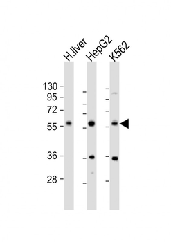 NAGS Antibody (Center)