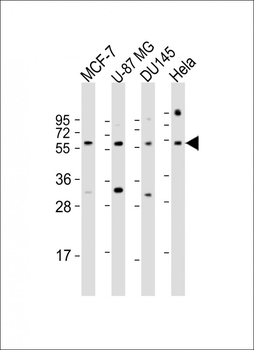 RGS3 Antibody (N-Term)