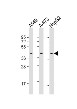 CSNK2A3 Antibody (C-Term)