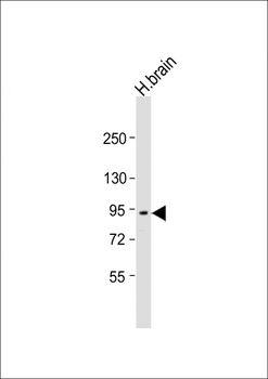 PRSS12 Antibody (N-Term)