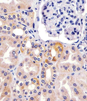 TIMP2 Antibody