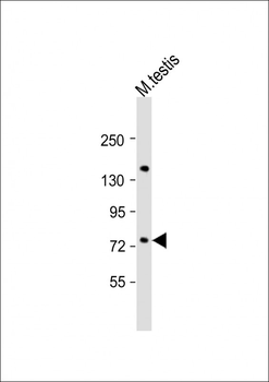 FLYWCH1 Antibody (Center)