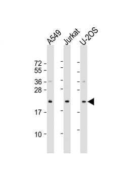 FAAP24 Antibody (N-Term)