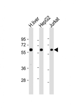 CYP2E1 Antibody (Center)