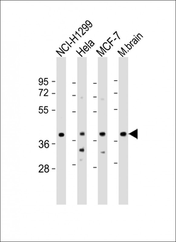 TWF1 Antibody (Center)