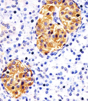RAB3B Antibody