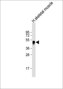WNT11 Antibody (Center)