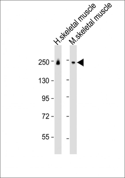 MYH8 Antibody (N-Term)