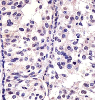 CDK4 Antibody