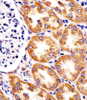 TST Antibody (Center)