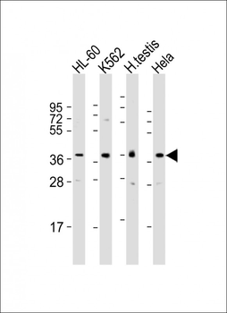 PRSS21 Antibody (N-Term)