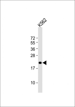 FEV Antibody (N-Term)