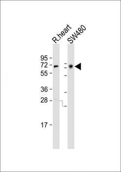 NGFR Antibody (C-term)