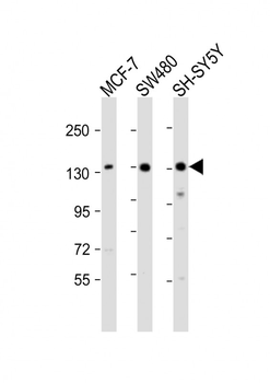 SRGAP2 Antibody (C-term)
