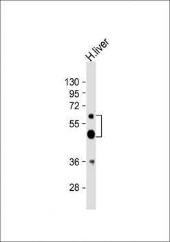 UGT2B4 Antibody (Center)