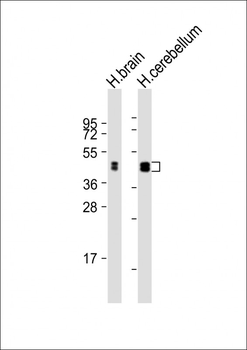 CNP Antibody (C-Term)