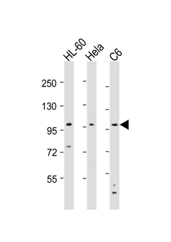NCSTN Antibody (N-Term)