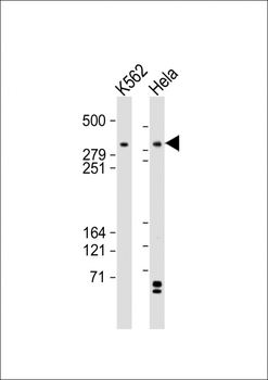 TRRAP Antibody (C-term)