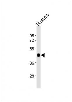 WNT7A Antibody