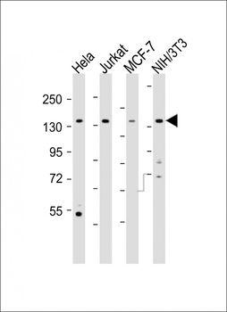 PLCG1 Antibody (Center)