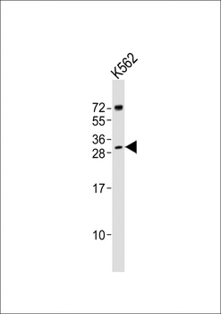 SRY Antibody (Center)