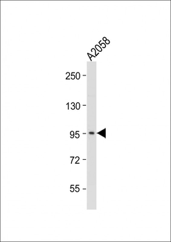 ADAMTS17 Antibody (Center)