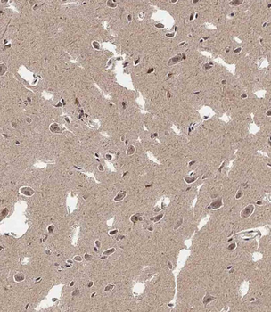 ADAMTS17 Antibody (Center)