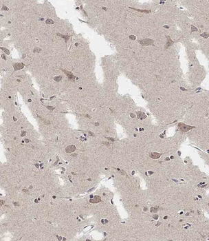 ADAMTS17 Antibody (Center)