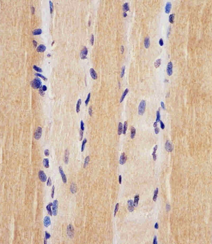 USP47 Antibody (Center)