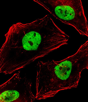 BCL9 Antibody (N-Term)