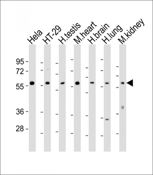 ETV1 Antibody (C-Term)