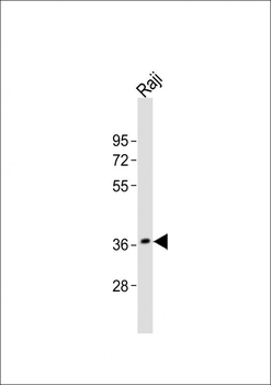 RASSF2 Antibody (N-Term)