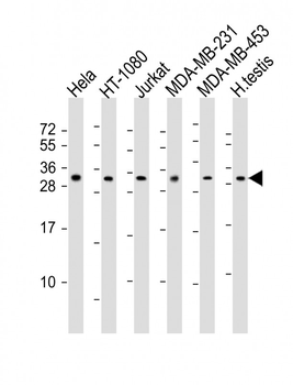SSX2 Antibody (Center)