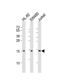 KISS1 Antibody (C-Term)