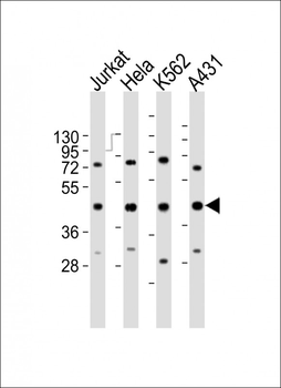 RBMX Antibody (Center)