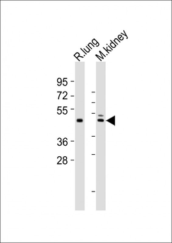 Mouse Dbx1 Antibody (C-term)