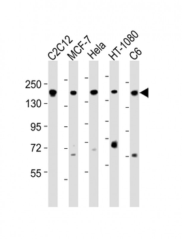 ROCK2 Antibody (C-term)