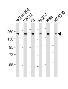 ROCK2 Antibody (C-term)