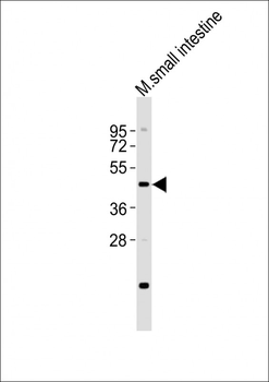 LMX1A Antibody (C-term)