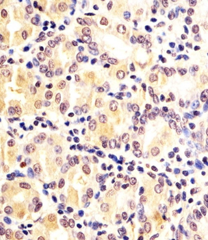 FN3KRP Antibody (N-Term)