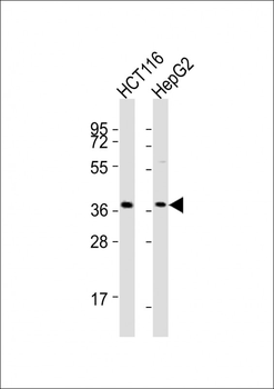 CTSL Antibody (N-Term)