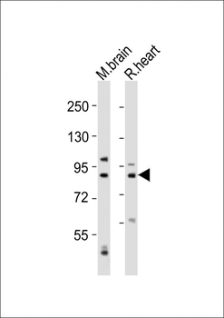CAPN5 Antibody (N-Term)