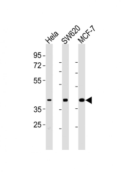 HPN Antibody (Center)