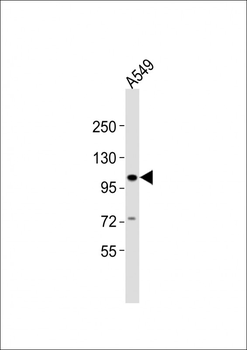 CHSY3 Antibody (C-term)